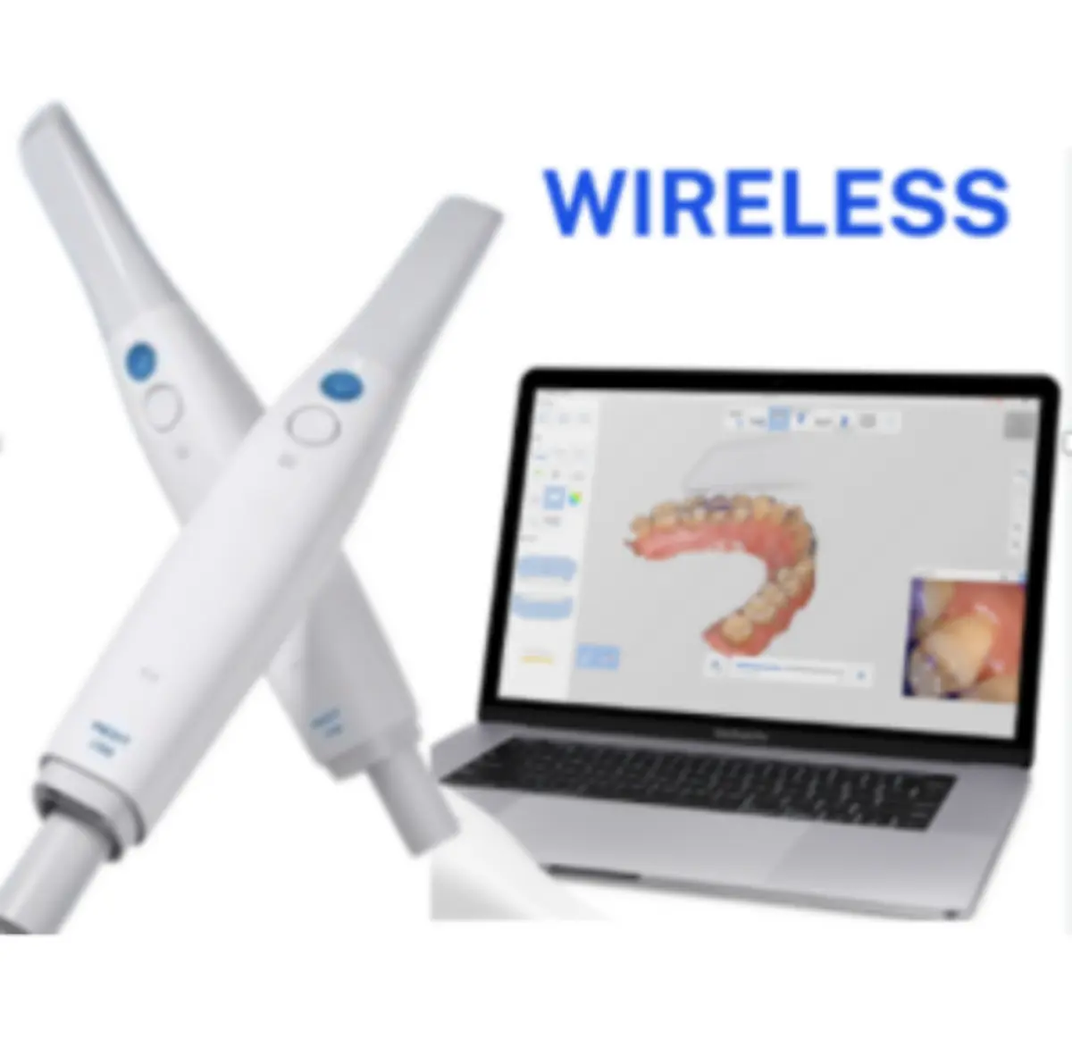 Scanner Intra Orale Wireless